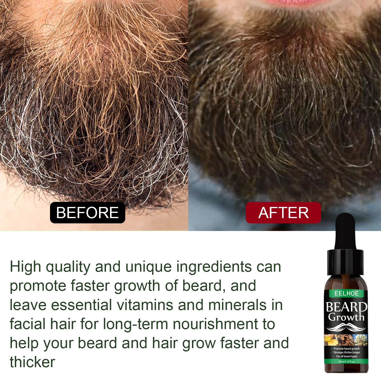 Beard Oil, Nourishing Moisturizing Spray Facial Hair Treatment Promotes Facial Growth And Thickening Liquid
