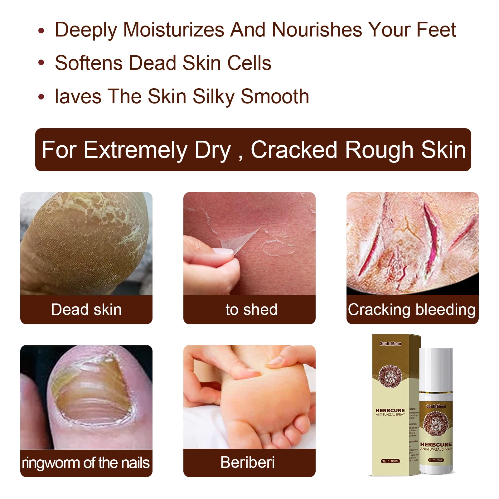 South Moon Herbal Foot Spray Moisturizes And Hydrates Foot Skin And Prevents Dry And Cracked Skin