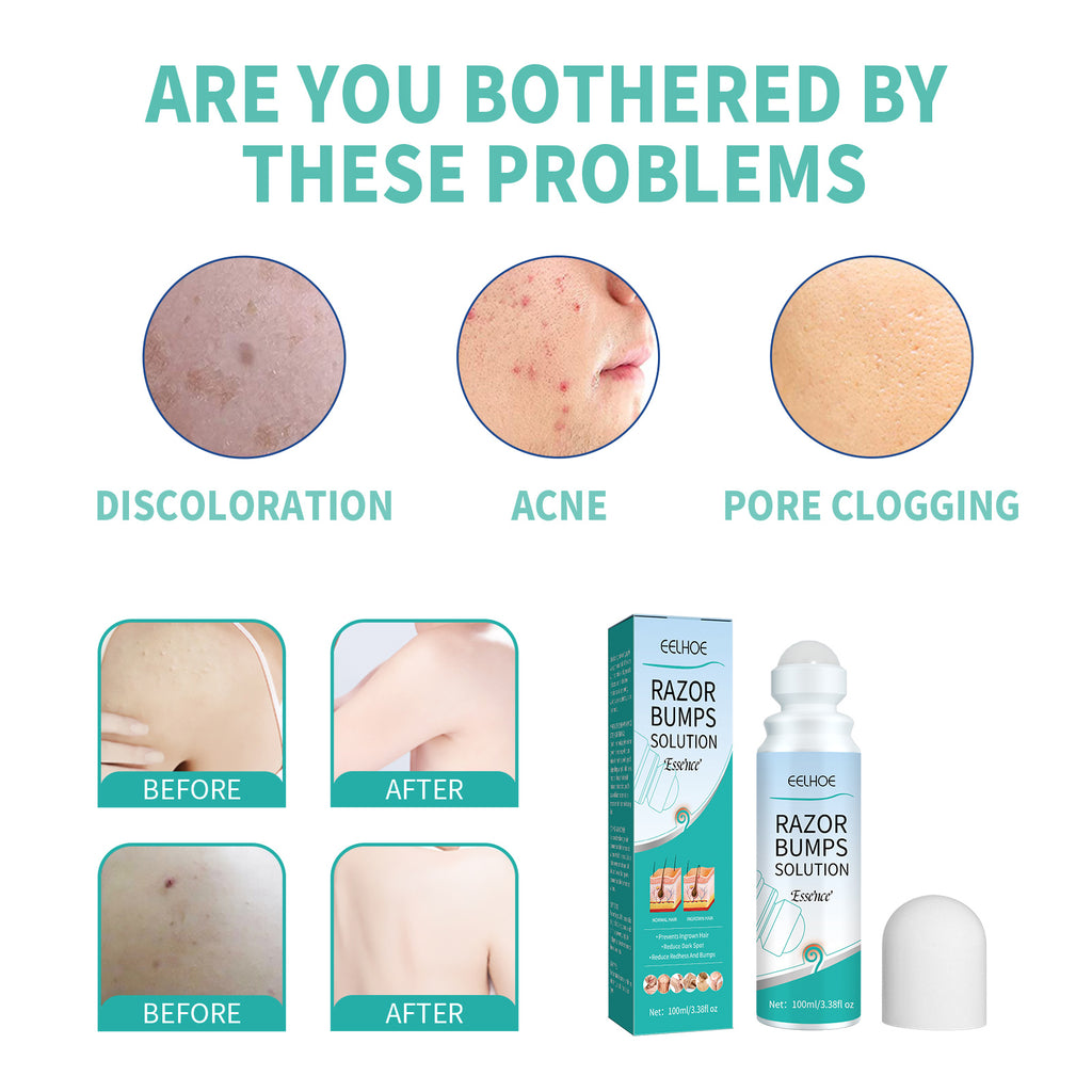 EELHOE Shaving Lump Repair Roll Essence, Prevent Hair From Growing Inward Essence And Repair Skin Bumps