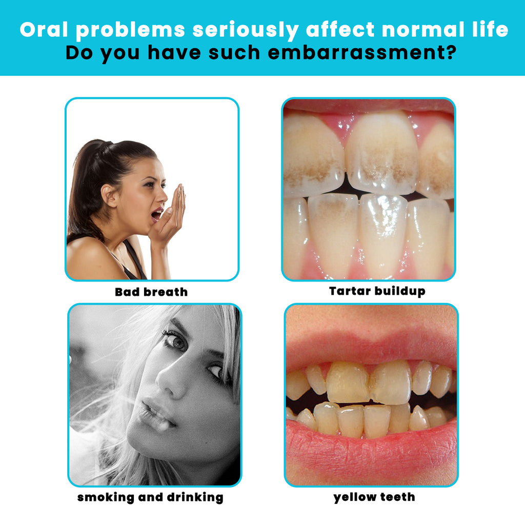 OUHOE White Teeth Mousse Clean Tartar Fresh Breath Anti-Decay Care For Gums Toothpaste Oral Cleaning