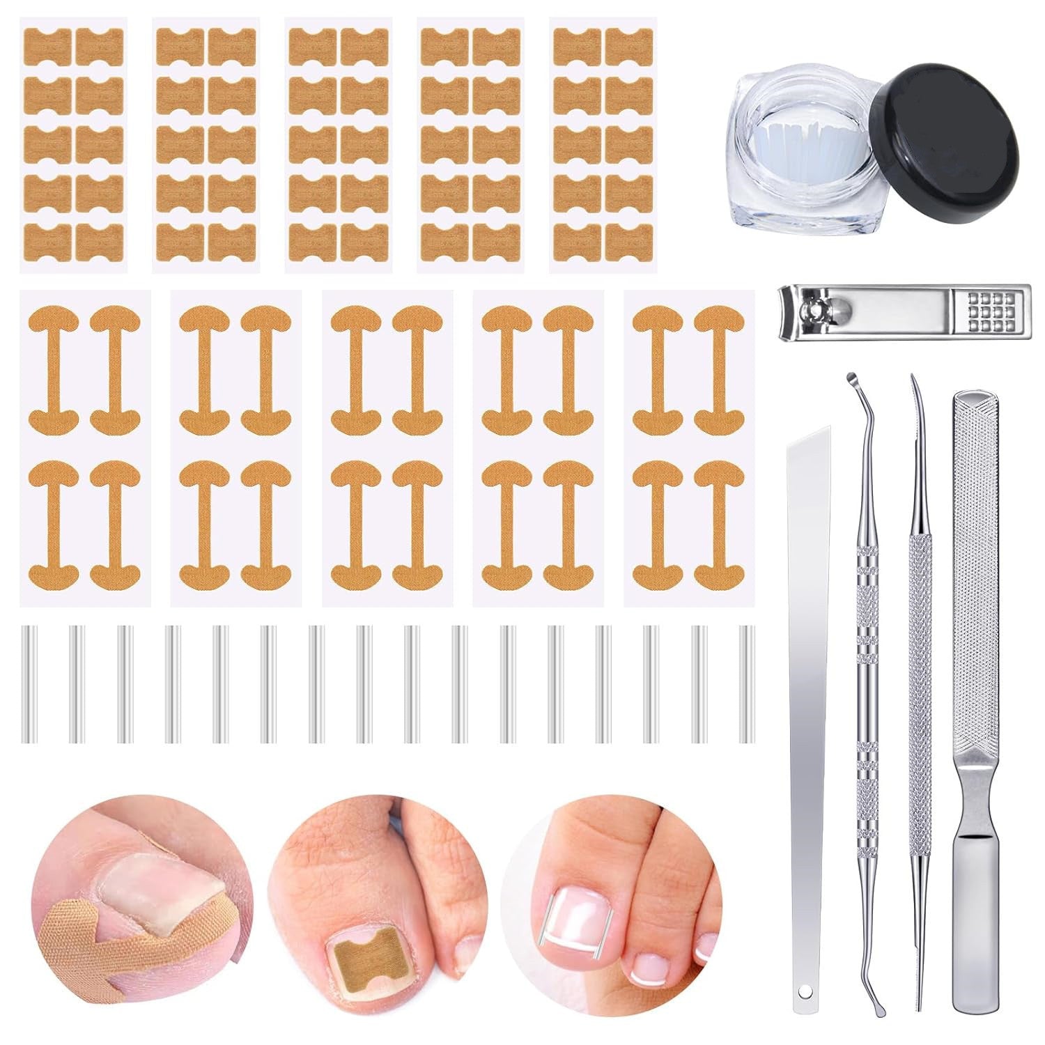 Nail Groove Embedded Nail Corrector Set Of Tools