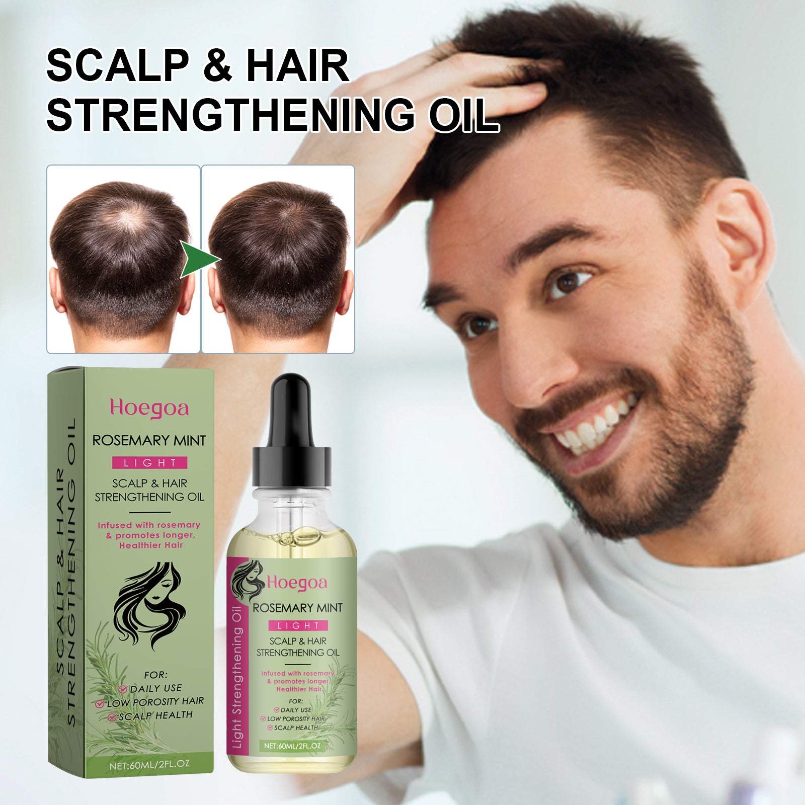 Hoegoa Rosemary Hair Care Essential Oil Softens Hair Repair Dry Hair Frizz And Moisturizes Hair End Care Essential Oil