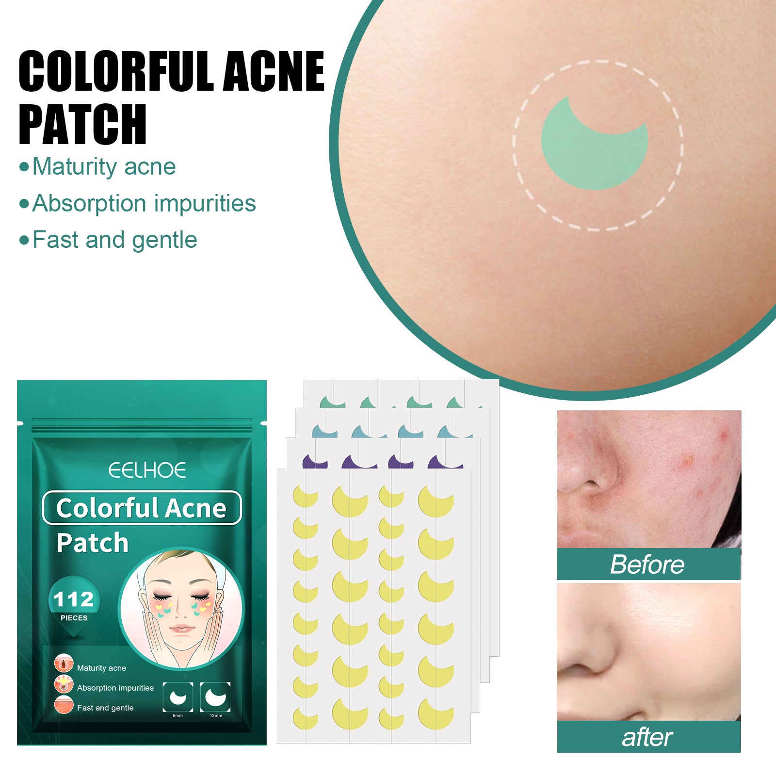 EELHOE Colorful Acne Patch, Repair And Clean The Mouth Blemish Clear Pocket Colorful Shaped Acne Patch