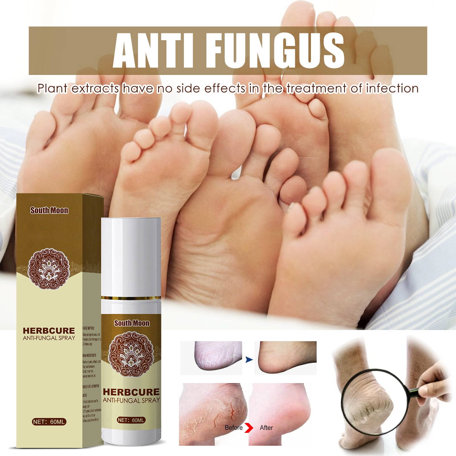 South Moon Herbal Foot Spray Moisturizes And Hydrates Foot Skin And Prevents Dry And Cracked Skin