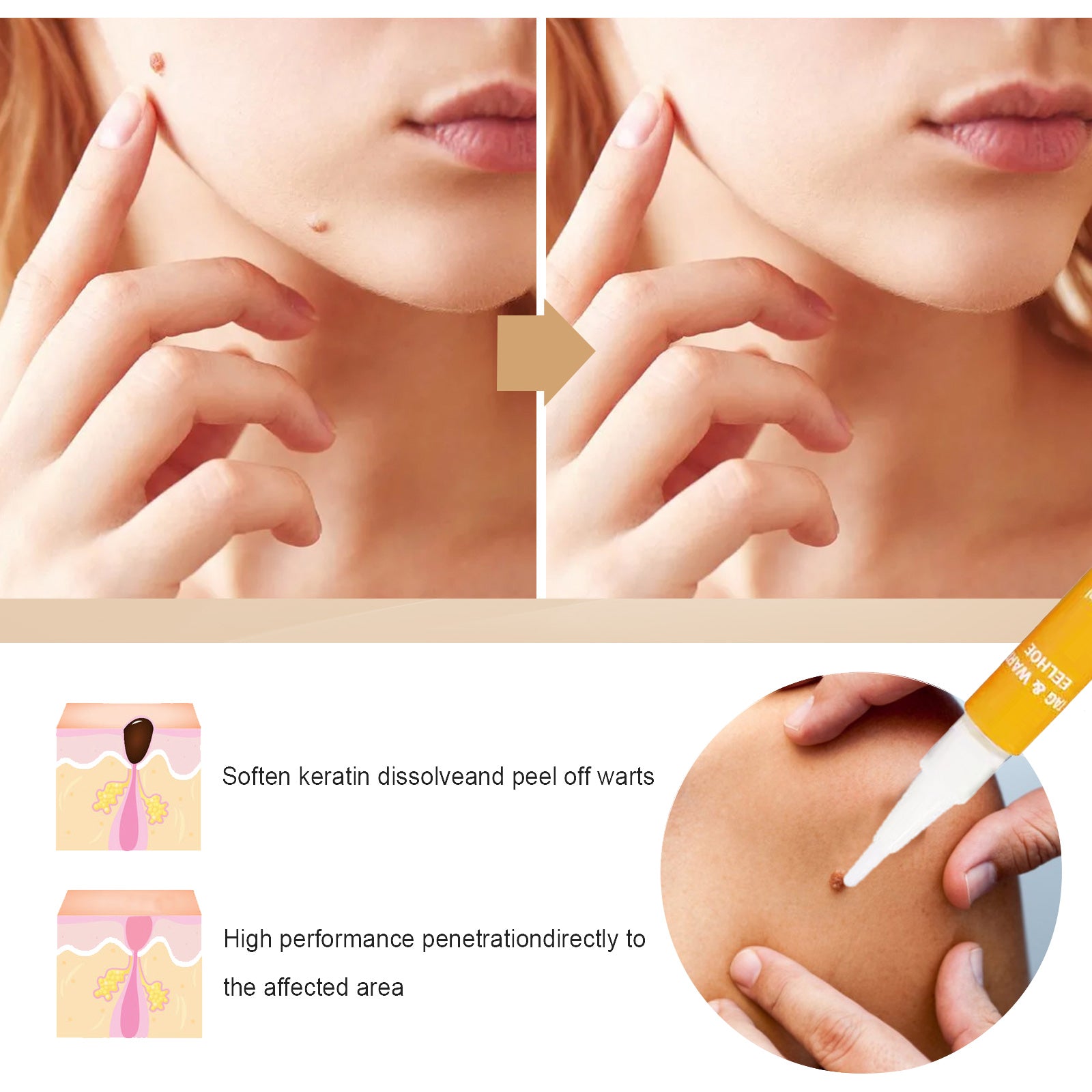 EELHOE Skin Repair Liquid Pen (1 Piece) Gently Repairs And Smooths Body Skin, Neck And Face Skin Care Pen